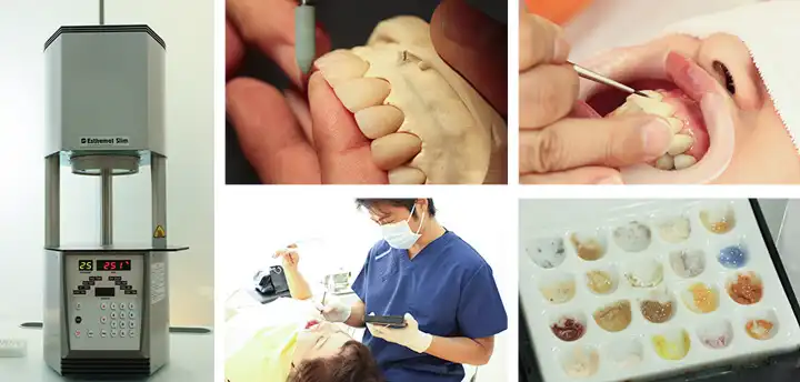 ドクターと技工士によるこだわりのステイニング