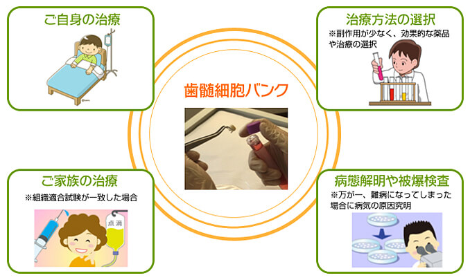 歯髄細胞バンクの利用例