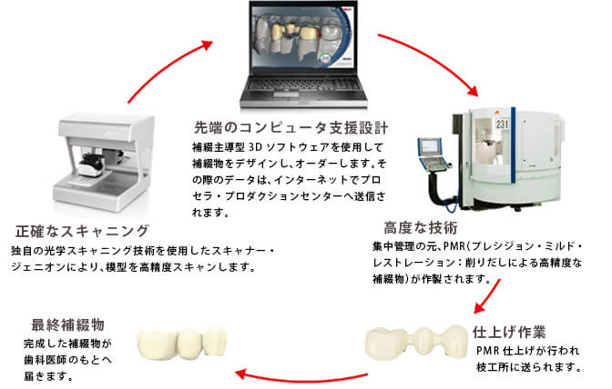 ノーベルプロセラ