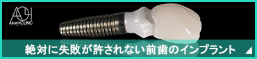 前歯のインプラント｜銀座でインプラントなら東京で数多くの症例の当クリニックへ。
